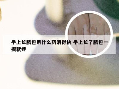 手上长脓包用什么药消得快 手上长了脓包一摸就疼