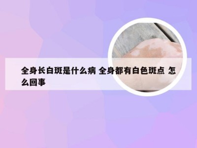 全身长白斑是什么病 全身都有白色斑点 怎么回事