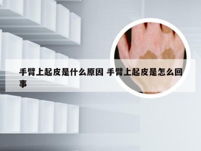 手臂上起皮是什么原因 手臂上起皮是怎么回事