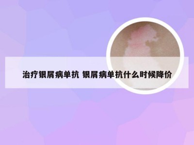 治疗银屑病单抗 银屑病单抗什么时候降价