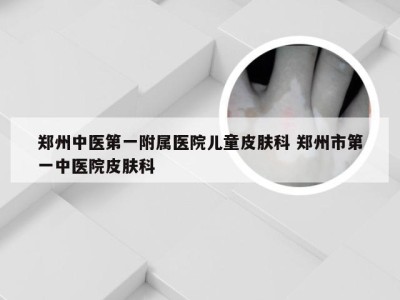 郑州中医第一附属医院儿童皮肤科 郑州市第一中医院皮肤科