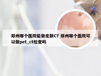 郑州哪个医院能做皮肤CT 郑州哪个医院可以做pet_ct检查吗