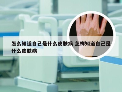 怎么知道自己是什么皮肤病 怎样知道自己是什么皮肤病