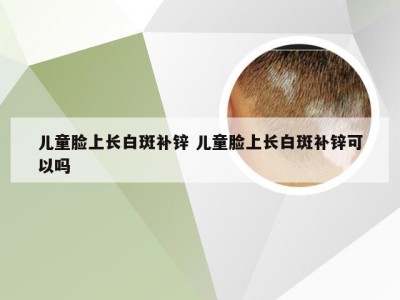 儿童脸上长白斑补锌 儿童脸上长白斑补锌可以吗