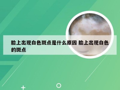 脸上出现白色斑点是什么原因 脸上出现白色的斑点