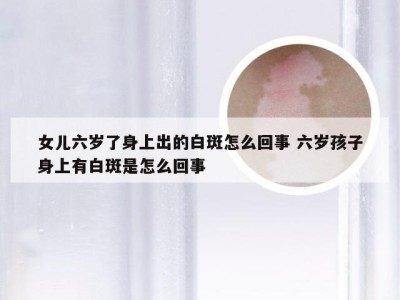 女儿六岁了身上出的白斑怎么回事 六岁孩子身上有白斑是怎么回事