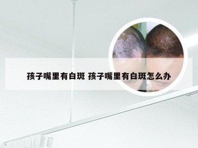 孩子嘴里有白斑 孩子嘴里有白斑怎么办