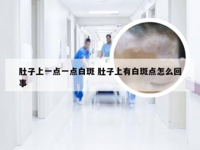 肚子上一点一点白斑 肚子上有白斑点怎么回事