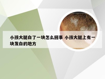 小孩大腿白了一块怎么回事 小孩大腿上有一块发白的地方