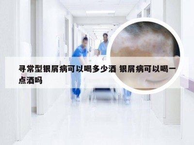 寻常型银屑病可以喝多少酒 银屑病可以喝一点酒吗