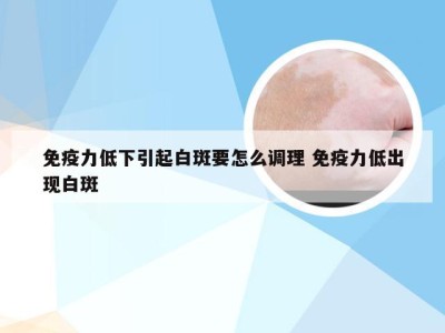 免疫力低下引起白斑要怎么调理 免疫力低出现白斑