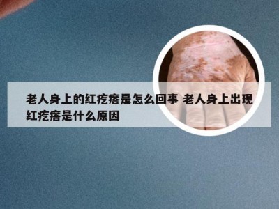 老人身上的红疙瘩是怎么回事 老人身上出现红疙瘩是什么原因