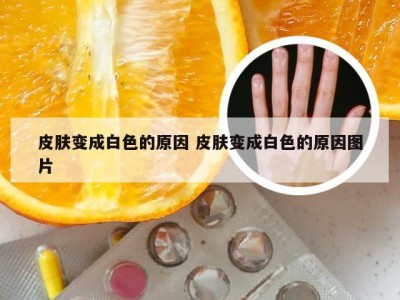 皮肤变成白色的原因 皮肤变成白色的原因图片