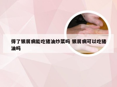 得了银屑病能吃猪油炒菜吗 银屑病可以吃猪油吗