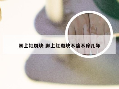 脚上红斑块 脚上红斑块不痛不痒几年