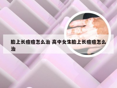 脸上长痘痘怎么治 高中女生脸上长痘痘怎么治