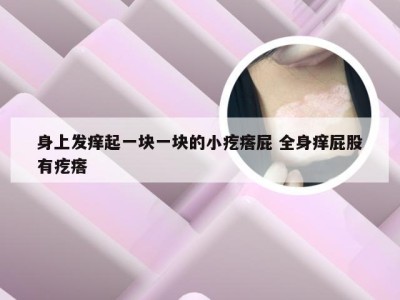 身上发痒起一块一块的小疙瘩屁 全身痒屁股有疙瘩