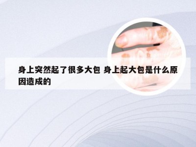 身上突然起了很多大包 身上起大包是什么原因造成的