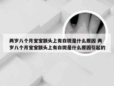 两岁八个月宝宝额头上有白斑是什么原因 两岁八个月宝宝额头上有白斑是什么原因引起的