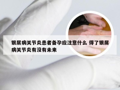 银屑病关节炎患者备孕应注意什么 得了银屑病关节炎有没有未来