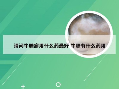 请问牛膝癣用什么药最好 牛膝有什么药用