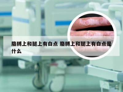 胳膊上和腿上有白点 胳膊上和腿上有白点是什么