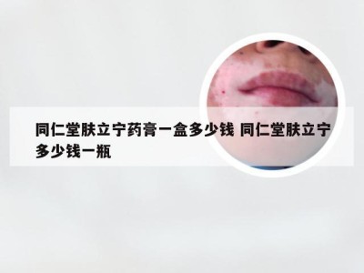 同仁堂肤立宁药膏一盒多少钱 同仁堂肤立宁多少钱一瓶