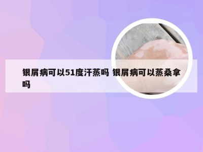 银屑病可以51度汗蒸吗 银屑病可以蒸桑拿吗