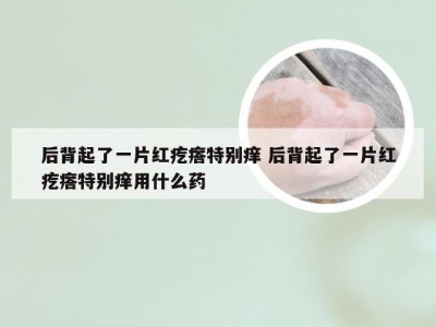 后背起了一片红疙瘩特别痒 后背起了一片红疙瘩特别痒用什么药