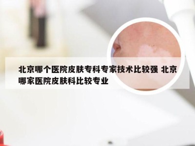 北京哪个医院皮肤专科专家技术比较强 北京哪家医院皮肤科比较专业