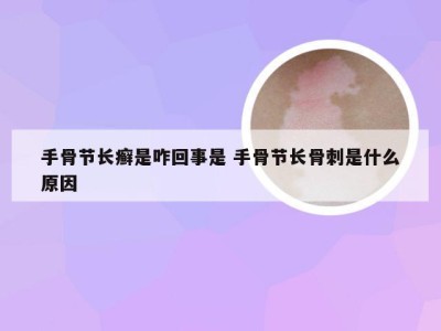 手骨节长癣是咋回事是 手骨节长骨刺是什么原因