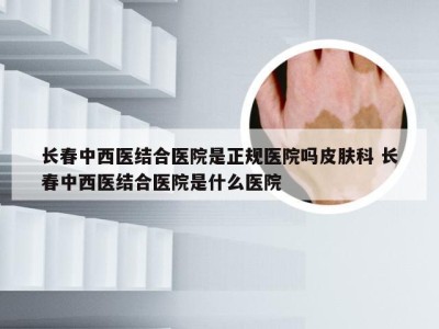 长春中西医结合医院是正规医院吗皮肤科 长春中西医结合医院是什么医院