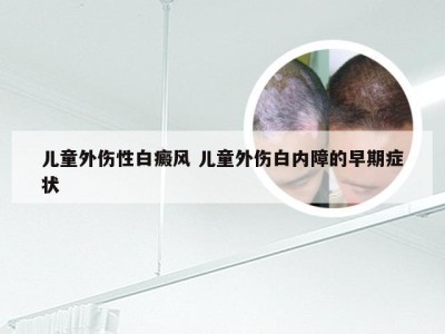 儿童外伤性白癜风 儿童外伤白内障的早期症状