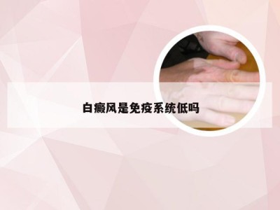 白癜风是免疫系统低吗