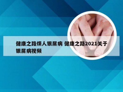 健康之路烦人银屑病 健康之路2021关于银屑病视频