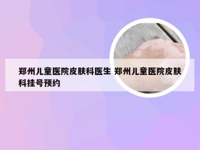 郑州儿童医院皮肤科医生 郑州儿童医院皮肤科挂号预约