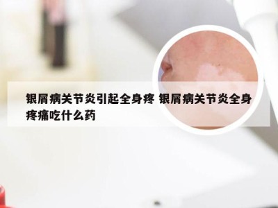 银屑病关节炎引起全身疼 银屑病关节炎全身疼痛吃什么药