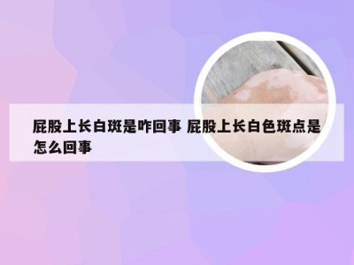 屁股上长白斑是咋回事 屁股上长白色斑点是怎么回事