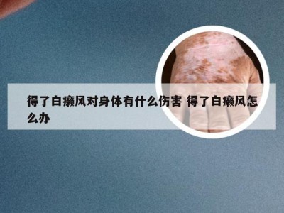 得了白癞风对身体有什么伤害 得了白癞风怎么办