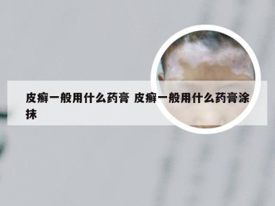 皮癣一般用什么药膏 皮癣一般用什么药膏涂抹