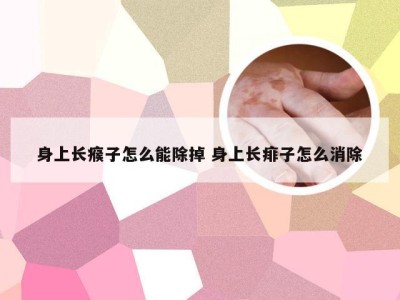 身上长瘊子怎么能除掉 身上长痱子怎么消除