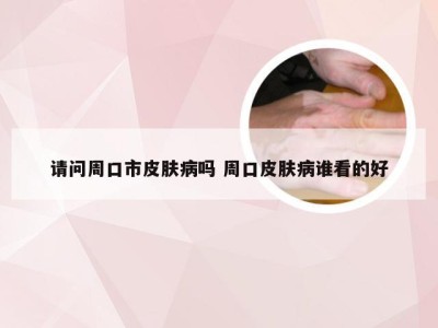 请问周口市皮肤病吗 周口皮肤病谁看的好