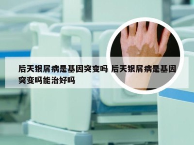 后天银屑病是基因突变吗 后天银屑病是基因突变吗能治好吗