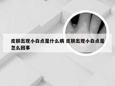 皮肤出现小白点是什么病 皮肤出现小白点是怎么回事