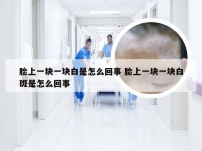 脸上一块一块白是怎么回事 脸上一块一块白斑是怎么回事