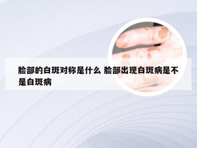 脸部的白斑对称是什么 脸部出现白斑病是不是白斑病