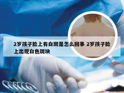 2岁孩子脸上有白斑是怎么回事 2岁孩子脸上出现白色斑块