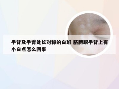 手背及手臂处长对称的白班 胳膊跟手背上有小白点怎么回事