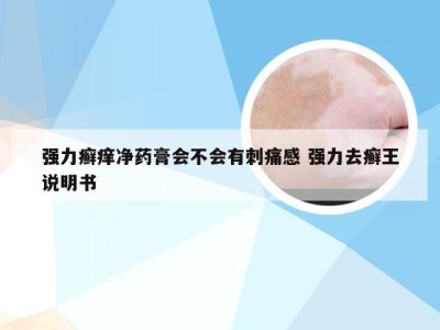 强力癣痒净药膏会不会有刺痛感 强力去癣王说明书