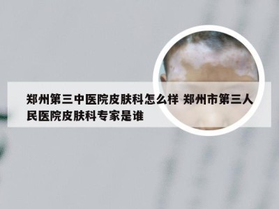 郑州第三中医院皮肤科怎么样 郑州市第三人民医院皮肤科专家是谁